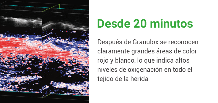 Granulox-feature 3